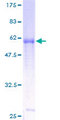 IL9R / CD129 Protein - 12.5% SDS-PAGE of human IL9R stained with Coomassie Blue