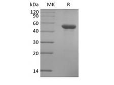 ILDR2 Protein - Recombinant Human ILDR2 (C-6His)