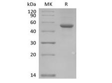 ILDR2 Protein - Recombinant Human ILDR2 (C-Fc)