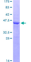 ILEI / FAM3C Protein - 12.5% SDS-PAGE of human FAM3C stained with Coomassie Blue