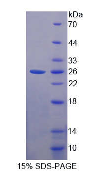 ILEI / FAM3C Protein - Recombinant  Family With Sequence Similarity 3, Member C By SDS-PAGE