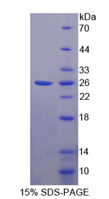 ILEI / FAM3C Protein - Recombinant  Family With Sequence Similarity 3, Member C By SDS-PAGE