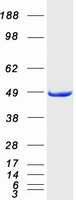 ILKAP Protein - Purified recombinant protein ILKAP was analyzed by SDS-PAGE gel and Coomassie Blue Staining