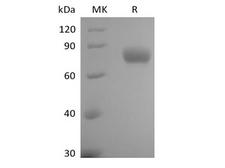 ILT2 / CD85 Protein - Recombinant Human Leukocyte Ig-Like Receptor B1/ LILRB1/ILT2/CD85j (C-6His-Avi) Biotinylated