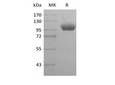 ILT2 / CD85 Protein - Recombinant Human Leukocyte Ig-Like Receptor B1/ LILRB1/ILT2/CD85j (C-Fc)