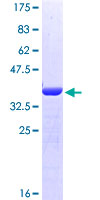 IMMT / Mitofilin Protein - 12.5% SDS-PAGE Stained with Coomassie Blue.