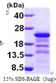 HIV-1 p24 Protein