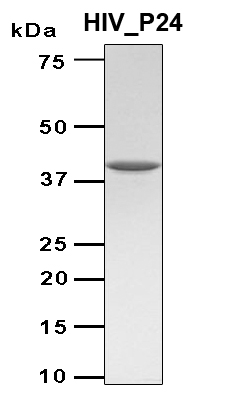 HIV-1 p24 Protein