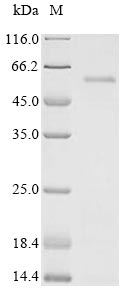 HIV-1 Vif Protein - (Tris-Glycine gel) Discontinuous SDS-PAGE (reduced) with 5% enrichment gel and 15% separation gel.