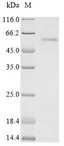 HIV-1 Vif Protein - (Tris-Glycine gel) Discontinuous SDS-PAGE (reduced) with 5% enrichment gel and 15% separation gel.