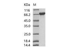 HIV-1 gag-pol Protein - Recombinant HIV-p66 / RT-p66 (group M, subtype B (isolate HXB2) Gag-Pol polyprotein Protein (His Tag)