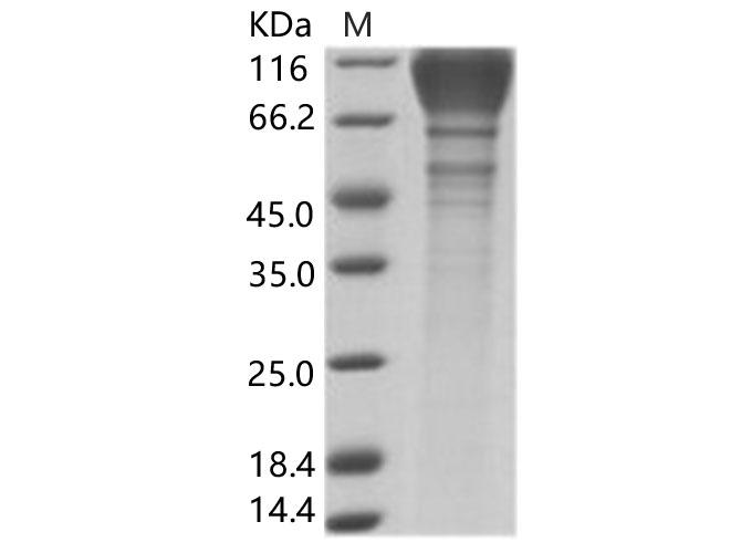 HIV-1 gp120 Protein - Recombinant HIV-1 (group M, subtype B, strain SHIV-89.6P) gp120 Protein (His Tag)