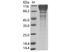 HIV-1 gp120 Protein - Recombinant HIV-1 (group M, subtype B, strain SHIV-89.6P) gp120 Protein (His Tag)