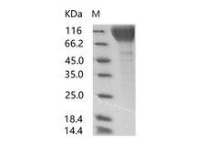 HIV-1 gp120 Protein - Recombinant HIV-1 gp120 Protein (group P, strain RBF168) (His Tag)
