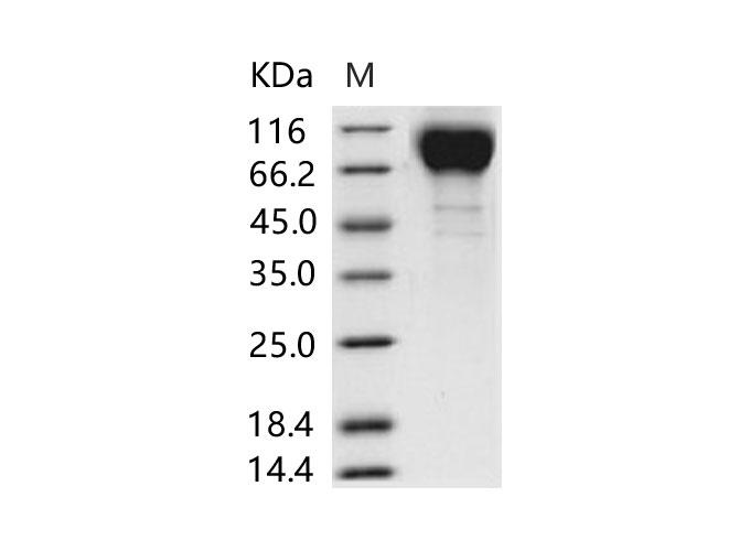HIV-1 gp120 Protein - Recombinant HIV-1 gp120 Protein (group M, subtype CRF07_BC) (His Tag)