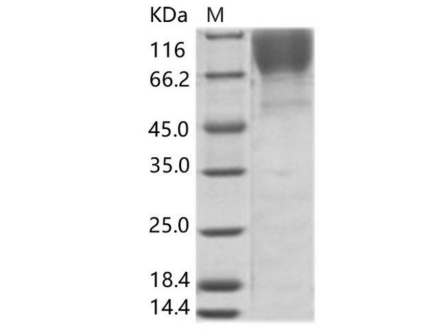 HIV-1 gp120 Protein - Recombinant HIV-1 (group M, subtype B, Isolate MN) gp120 Protein (His Tag)