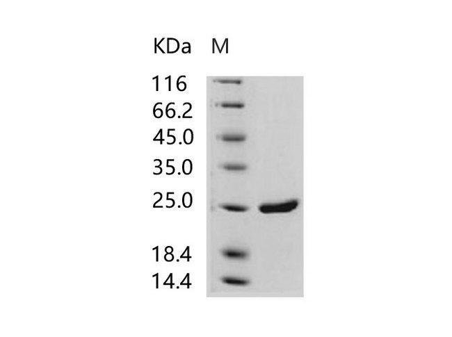 HIV-1 p24 Protein - Recombinant HIV-1 p24 Protein (group M, subtype B, strain 92418) (His Tag)