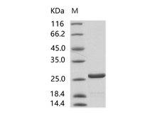 HIV-1 p24 Protein - Recombinant HIV-1 p24 protein (group N, strain 06CM-U14296) (His Tag)