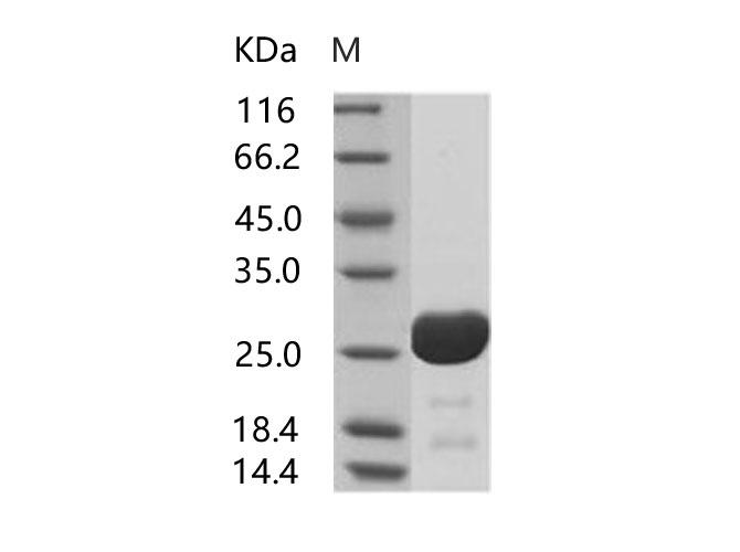 HIV-1 p24 Protein - Recombinant HIV-1 p24 Protein (group O, strain BCF06) (His Tag)