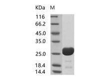 HIV-1 p24 Protein - Recombinant HIV-1 p24 Protein (group O, strain BCF06) (His Tag)