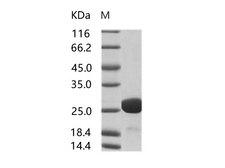 HIV-1 p24 Protein - Recombinant HIV-1 p24 Protein (group M, subtype D, strain NDK) (His Tag)