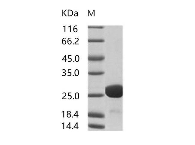 HIV-1 p24 Protein - Recombinant HIV-1 p24 Protein (group M, subtype D, strain NDK) (His Tag)