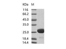 HIV-1 p24 Protein - Recombinant HIV-1 p24 Protein (group M, subtype B, strain HXB2) (His Tag)
