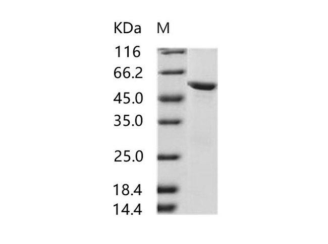 HIV-2 Envelope glycoprotein gp36 Protein - Recombinant HIV-2 gp36 Protein (subtype CRF01_AB, strain 07JP_NMC716_clone_01) (His & MBP Tag)