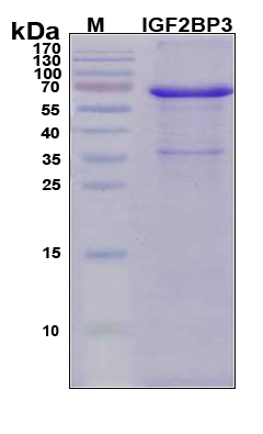 IMP-3 / IGF2BP3 Protein - SDS-PAGE under reducing conditions and visualized by Coomassie blue staining