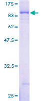 IMP-3 / IGF2BP3 Protein - 12.5% SDS-PAGE of human IMP-3 stained with Coomassie Blue