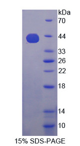IMP-3 / IGF2BP3 Protein - Recombinant  Insulin Like Growth Factor 2 mRNA Binding Protein 3 By SDS-PAGE