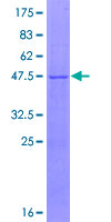 IMP3 Protein - 12.5% SDS-PAGE of human IMP3 stained with Coomassie Blue