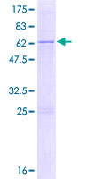 IMP4 Protein - 12.5% SDS-PAGE of human IMP4 stained with Coomassie Blue