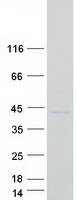 IMP4 Protein - Purified recombinant protein IMP4 was analyzed by SDS-PAGE gel and Coomassie Blue Staining