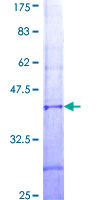 IMP5 Protein - 12.5% SDS-PAGE Stained with Coomassie Blue.