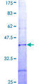 IMP5 Protein - 12.5% SDS-PAGE Stained with Coomassie Blue.
