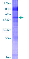 IMPA2 Protein - 12.5% SDS-PAGE of human IMPA2 stained with Coomassie Blue