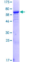 IMPAD1 Protein - 12.5% SDS-PAGE of human IMPAD1 stained with Coomassie Blue