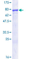 IMPDH1 Protein - 12.5% SDS-PAGE of human IMPDH1 stained with Coomassie Blue
