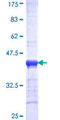 IMPDH1 Protein - 12.5% SDS-PAGE Stained with Coomassie Blue.