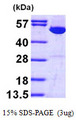 IMPDH1 Protein