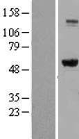 IMPDH2 Protein - Western validation with an anti-DDK antibody * L: Control HEK293 lysate R: Over-expression lysate