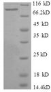 IMPDH2 Protein - (Tris-Glycine gel) Discontinuous SDS-PAGE (reduced) with 5% enrichment gel and 15% separation gel.