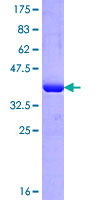 IMPG2 Protein - 12.5% SDS-PAGE Stained with Coomassie Blue.