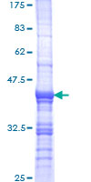 INADL / PATJ Protein - 12.5% SDS-PAGE Stained with Coomassie Blue.