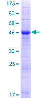 INF2 Protein - 12.5% SDS-PAGE of human INF2 stained with Coomassie Blue