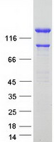 INF2 Protein - Purified recombinant protein INF2 was analyzed by SDS-PAGE gel and Coomassie Blue Staining