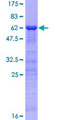 ING1 Protein - 12.5% SDS-PAGE of human ING1 stained with Coomassie Blue