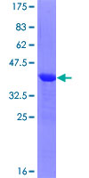 ING1 Protein - 12.5% SDS-PAGE Stained with Coomassie Blue.