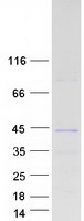 ING1 Protein - Purified recombinant protein ING1 was analyzed by SDS-PAGE gel and Coomassie Blue Staining